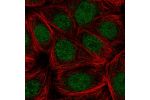 Immunofluorescent staining of human cell line MCF7 shows localization to nucleus.