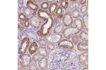 Immunohistochemical staining of human kidney shows cytoplasmic positivity in tubules.