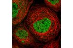 Immunofluorescent staining of human cell line A-431 shows localization to nucleoplasm.