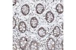 Immunohistochemical staining of human colon shows strong nuclear positivity in glandular cells.