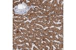 Immunohistochemical staining of human liver shows strong granular cytoplasmic positivity in hepatocytes.