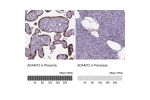 Immunohistochemistry analysis in human placenta and pancreas tissues using HPA030866 antibody. Corresponding ADAM12 RNA-seq data are presented for the same tissues.