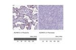 Immunohistochemistry analysis in human placenta and pancreas tissues using HPA030867 antibody. Corresponding ADAM12 RNA-seq data are presented for the same tissues.