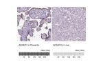 Immunohistochemistry analysis in human placenta and liver tissues using HPA030868 antibody. Corresponding ADAM12 RNA-seq data are presented for the same tissues.