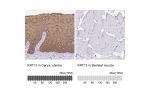 Immunohistochemistry analysis in human cervix, uterine and skeletal muscle tissues using HPA030877 antibody. Corresponding KRT13 RNA-seq data are presented for the same tissues.