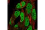 Immunofluorescent staining of human cell line RH-30 shows localization to nucleoplasm.