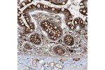 Immunohistochemical staining of human small intestine shows strong cytoplasmic positivity in glandular as well as lymphoid cells.