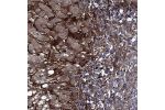 Immunohistochemical staining of human liver shows strong cytoplasmic and extracellular positivity.