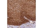 Immunohistochemical staining of human esophagus shows strong cytoplasmic positivity in squamous epithelial cells.