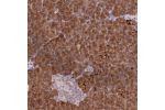 Immunohistochemical staining of human pancreas shows strong cytoplasmic positivity in exocrine glandular cells.