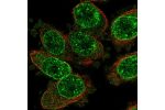 Immunofluorescent staining of human cell line PC-3 shows localization to nuclear membrane.