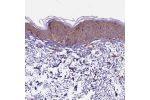 Immunohistochemical staining of human skin shows moderate cytoplasmic positivity and strong nuclear positivity in squamous epithelial cells.