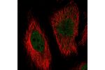 Immunofluorescent staining of human cell line HeLa shows localization to nucleoplasm.