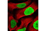 Immunofluorescent staining of human cell line U-2 OS shows localization to nucleoplasm.
