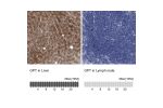 Immunohistochemistry analysis in human liver and lymph node tissues using HPA031060 antibody. Corresponding GPT RNA-seq data are presented for the same tissues.