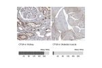 Immunohistochemistry analysis in human kidney and skeletal muscle tissues using HPA031068 antibody. Corresponding CTSA RNA-seq data are presented for the same tissues.