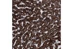 Immunohistochemical staining of human liver shows strong granular cytoplasmic positivity in hepatocytes.