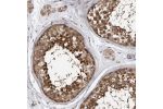 Immunohistochemical staining of human testis shows strong nuclear and cytoplasmic positivity in cells in seminiferus ducts.