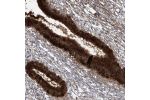 Immunohistochemical staining of human cervix, uterine shows strong cytoplasmic positivity in glandular cells.