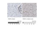 Immunohistochemistry analysis in human breast and cerebral cortex tissues using Anti-FKBP5 antibody. Corresponding FKBP5 RNA-seq data are presented for the same tissues.