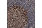 Immunohistochemical staining of human lymph node shows moderate to strong nuclear positivity in germinal center cells.