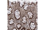 Immunohistochemical staining of human rectum shows strong nuclear and cytoplasmic positivity in glandular cells.
