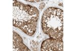 Immunohistochemical staining of human testis shows strong cytoplasmic positivity in cells in seminiferous ducts.