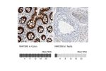 Immunohistochemistry analysis in human colon and testis tissues using Anti-MAP2K6 antibody. Corresponding MAP2K6 RNA-seq data are presented for the same tissues.