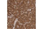 Immunohistochemical staining of human pancreas shows strong cytoplasmic positivity in exocrine glandular cells.