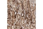 Immunohistochemical staining of human kidney shows moderate to strong positivity in tubular cells.