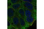 Immunofluorescent staining of human cell line RT4 shows localization to plasma membrane.