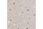 Immunohistochemical staining of human cerebral cortex shows moderate cytoplasmic positivity in neuronal cells.