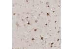 Immunohistochemical staining of human cerebral cortex shows strong cytoplasmic positivity in neuronal cells.