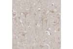 Immunohistochemical staining of human cerebral cortex shows moderate cytoplasmic positivity in neuronal cells.