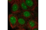 Immunofluorescent staining of human cell line MCF7 shows localization to nucleus & nucleoli.