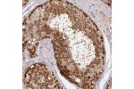 Immunohistochemical staining of human testis shows strong cytoplasmic positivity in cells in seminiferus ducts.