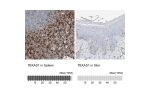 Immunohistochemistry analysis in human spleen and skin tissues using Anti-TBXAS1 antibody. Corresponding TBXAS1 RNA-seq data are presented for the same tissues.