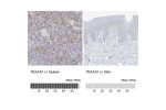 Immunohistochemistry analysis in human spleen and skin tissues using Anti-TBXAS1 antibody. Corresponding TBXAS1 RNA-seq data are presented for the same tissues.