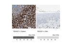 Immunohistochemistry analysis in human spleen and skin tissues using Anti-TBXAS1 antibody. Corresponding TBXAS1 RNA-seq data are presented for the same tissues.