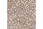 Immunohistochemical staining of human liver shows moderate nuclear positivity in hepatocytes.