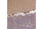 Immunohistochemical staining of human cerebellum shows strong cytoplasmic positivity in Purkinje cells.