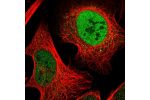 Immunofluorescent staining of human cell line U-2 OS shows localization to nucleoplasm.