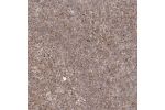 Immunohistochemical staining of human tonsil shows strong cytoplasmic positivity in non-germinal center cells.
