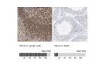 Immunohistochemistry analysis in human spleen and pancreas tissues using Anti-HLA-E antibody. Corresponding HLA-E RNA-seq data are presented for the same tissues.