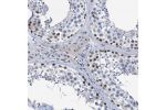 Immunohistochemical staining of human testis shows weak to moderate nuclear positivity in cells in seminiferous ducts.