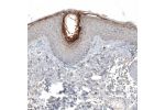 Immunohistochemical staining of human skin shows moderate to strong cytoplasmic granular positivity in the cornified layer.