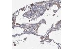 Immunohistochemical staining of human lung shows strong cytoplasmic positivity in macrophages.
