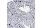 Immunohistochemical staining of human testis shows strong nuclear positivity in a subset of cells in seminiferous ducts.