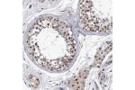 Immunohistochemical staining of human testis shows moderate to strong nuclear positivity in cells in seminiferous ducts.