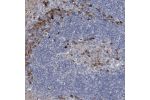 Immunohistochemical staining of human tonsil shows moderate to strong cytoplasmic positivity in a subset of lymphoid cells.